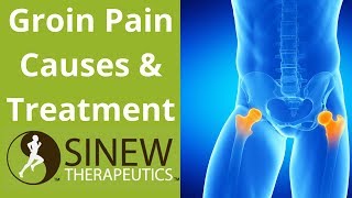 Groin Pain Causes and Treatment [upl. by Aisyla602]