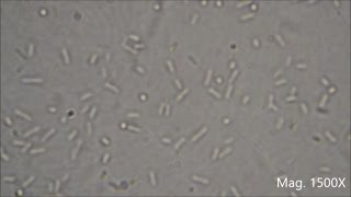 Bacteria under the Microscope E coli and S aureus [upl. by Gabbi280]