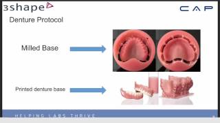 Digital Dentures What You Need to Know [upl. by Anahs]