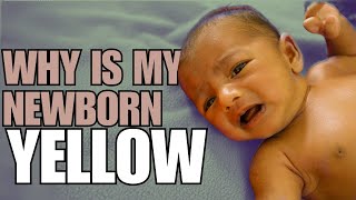 Newborn Jaundice Causes Symptoms and Treatment [upl. by Judon197]