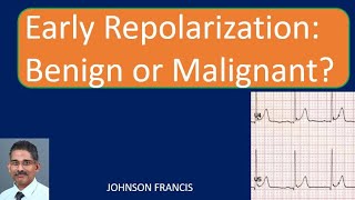 Early Repolarization Benign or Malignant [upl. by Nylak]