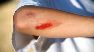 How to Treat Cuts amp Scrapes  First Aid Training [upl. by Iras]