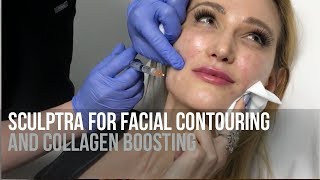 Facial Sculpting with Sculptra Injections  Cosmetic Treatment by Dr Jason Emer  LIVE [upl. by Janella]