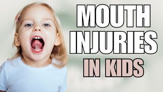 Pediatrician Explains What to do When Your Child Has a Mouth Injury [upl. by Onihc]