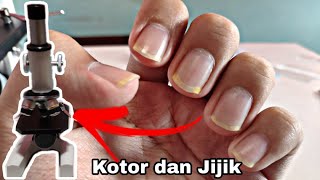 Kuku Panjang dan Kotor  Dirty Nail Under Microscope [upl. by Pasho354]