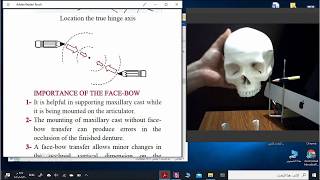 Kinematic facebow [upl. by Weibel]