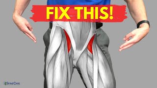 How to Relieve Hip Flexor Pain in 30 SECONDS [upl. by Salvatore]