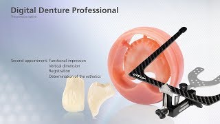 Digital Denture – second Appointment [upl. by Arahc]